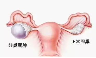 月经推迟几天算怀孕？——揭开月经周期与妊娠的神秘面纱