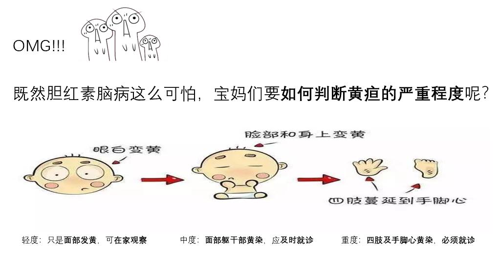 新生儿黄疸，理解症状、预防措施及合理用药指南