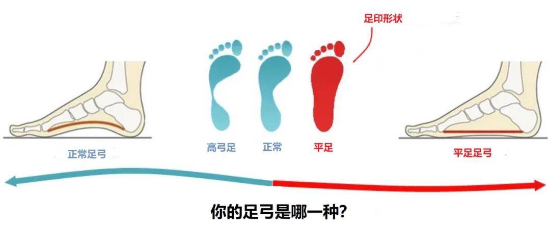 小孩脚麻，原因、症状与应对策略