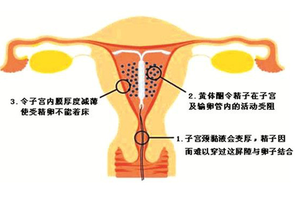 怀孕后白带发黄的秘密与应对策略